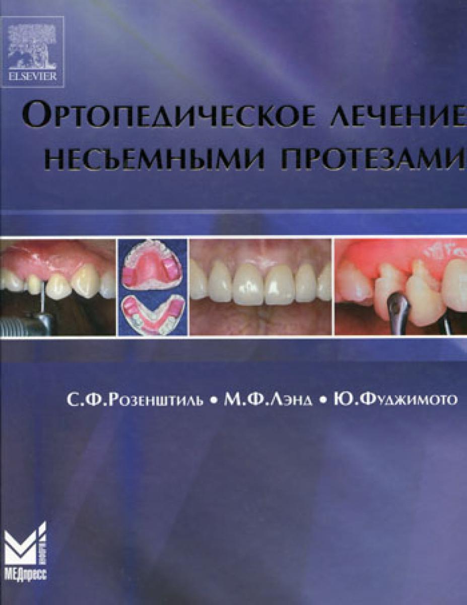 Ортопедическое лечение. Ортопедическое лечение несъемными протезами. Ортопедическое лечение несъемными протезами Розенштиль. Несъемное протезирование учебник. Атлас несъемного протезирования..